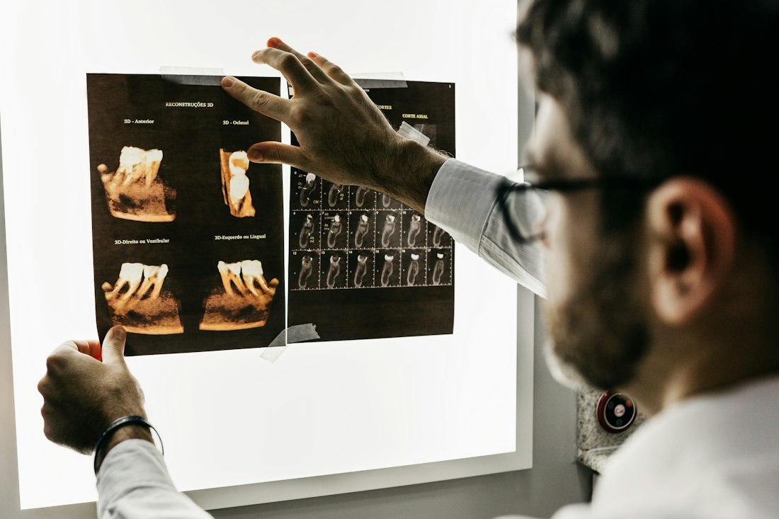 Dentist reviewing X-ray